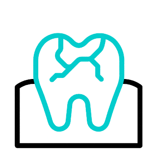 Emergency Dental Care - Broken, Chipped or Cracked Teeth